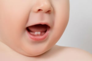 О чём сигнализирует потемнение молочных зубов?